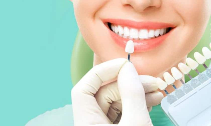 Choosing the Right Material for Your Dental Veneer Procedure