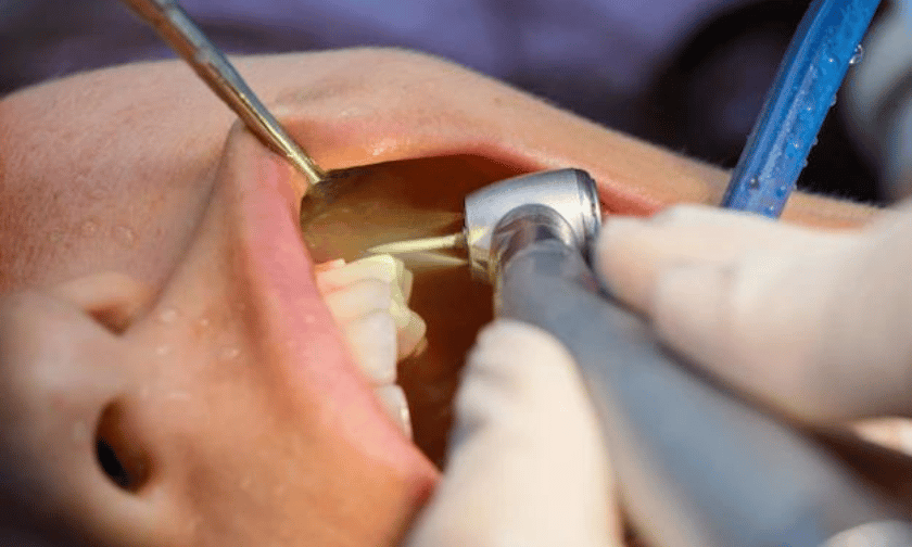 How Often Should You Have a Dental Cleaning and Exam