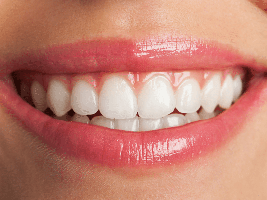 What Are the Benefits of Gum Contouring? - Smile Dental Center